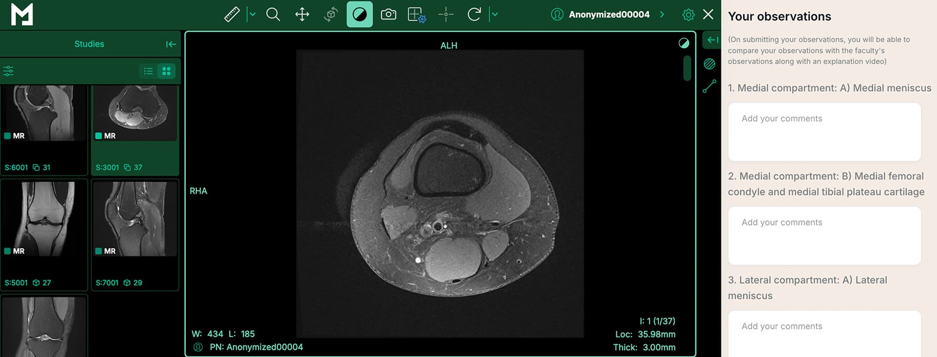 Expert Imaging Emulator